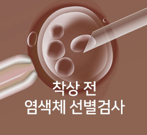 착상 전 염색체검사